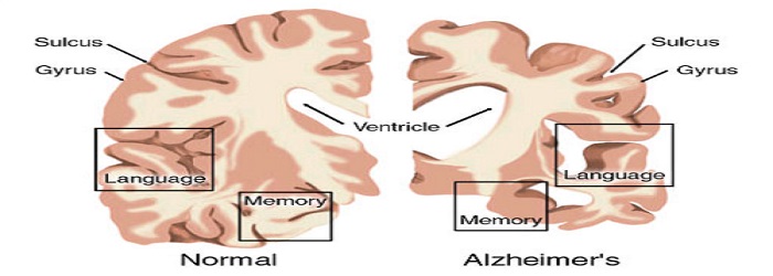 The Brain Stimulator Method